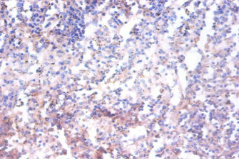 AHSA1 Polyclonal Antibody - image 3