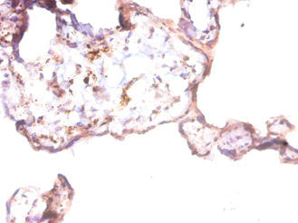 ANGPT1 Polyclonal Antibody - image 3