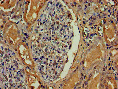 ANGPT2 Polyclonal Antibody - image 4