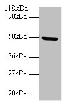 Immunohistochemistry of paraffin-embedded human kidney tissue using CAC14083 at dilution of 1:100