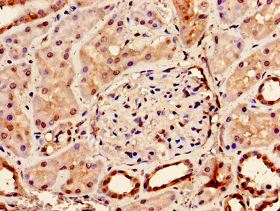 Immunohistochemistry of paraffin-embedded human brain tissue using CAC14083 at dilution of 1:100