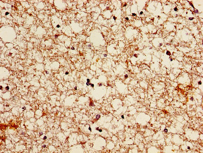 Immunofluorescent analysis of Hela cells using CAC14083 at dilution of 1:100 and Alexa Fluor 488-congugated AffiniPure Goat Anti-Rabbit IgG(H+L)
