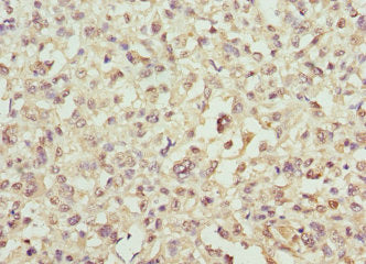 SNCA Polyclonal Antibody - image 3