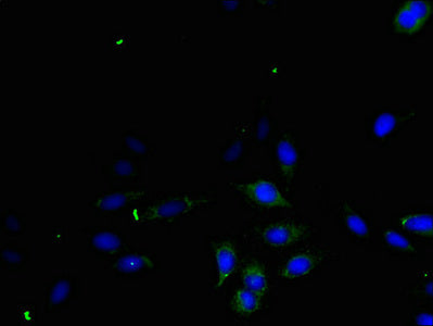 Immunohistochemistry of paraffin-embedded human melanoma using CAC14099 at dilution of 1:100