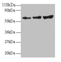 TIMP2 Polyclonal Antibody - image 2