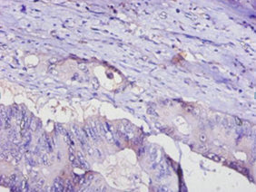 Western Blot, Positive WB detected in: Mouse heart tissue, Mouse liver tissue, Mouse kidney tissue, Mouse skeletal muscle tissue, All lanes: ADIPOQ antibody at 4ug/ml, Secondary, Goat polyclonal to rabbit IgG at 1/50000 dilution, Predicted band size: 27 kDa, Observed band size: 27 kDa