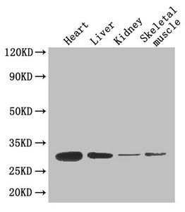 ADIPOQ Polyclonal Antibody - image 3
