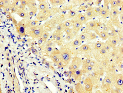 IHC image of CAC14118 diluted at 1:400 and staining in paraffin-embedded human prostate tissue performed on a Leica BondTM system. After dewaxing and hydration, antigen retrieval was mediated by high pressure in a citrate buffer (pH 6.0). Section was blocked with 10% normal goat serum 30min at RT. Then primary antibody (1% BSA) was incubated at 4°C overnight. The primary is detected by a biotinylated secondary antibody and visualized using an HRP conjugated SP system.