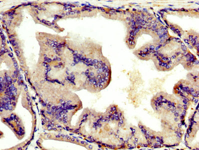 AGT Polyclonal Antibody - image 5