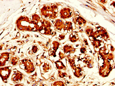 Immunofluorescence staining of Hela cells with CAC14119 at 1:100, counter-stained with DAPI. The cells were fixed in 4% formaldehyde, permeabilized using 0.2% Triton X-100 and blocked in 10% normal Goat Serum. The cells were then incubated with the antibody overnight at 4°C. The secondary antibody was Alexa Fluor 488-congugated AffiniPure Goat Anti-Rabbit IgG(H+L).