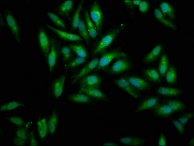 Immunoprecipitating MSLN in HepG2 whole cell lysate, Lane 1: Rabbit control IgG instead of CAC14119 in HepG2 whole cell lysate. For western blotting, a HRP-conjugated Protein G antibody was used as the secondary antibody (1/2000), Lane 2: CAC14119 (8ug) + HepG2 whole cell lysate (500ug), Lane 3: HepG2 whole cell lysate (10ug)