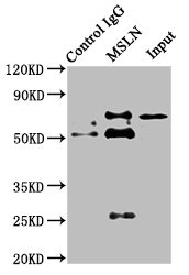 MSLN Polyclonal Antibody - image 5