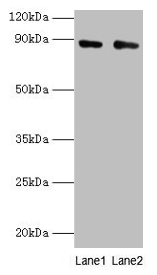 Immunohistochemistry of paraffin-embedded human liver cancer using CAC14124 at dilution of 1:100