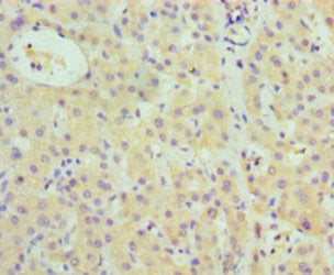Immunohistochemistry of paraffin-embedded human adrenal gland tissue using CAC14124 at dilution of 1:100
