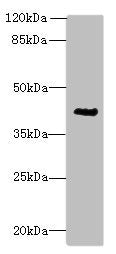 Immunohistochemistry of paraffin-embedded human prostate cancer using CAC14133 at dilution of 1:100