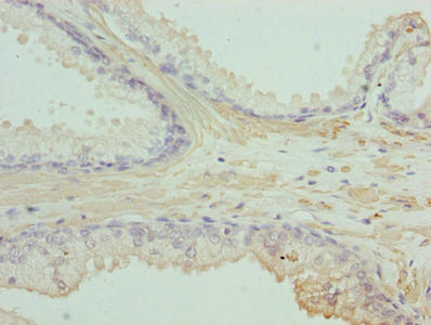 Immunohistochemistry of paraffin-embedded human colon tissue using CAC14133 at dilution of 1:100