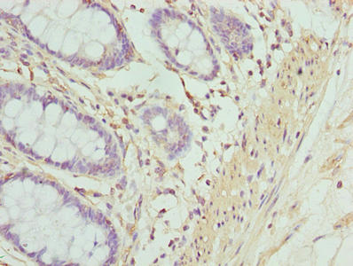 ACTG2 Polyclonal Antibody - image 4
