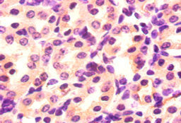 Immunohistochemistry of paraffin-embedded human placenta tissue using CAC14147 at dilution of 1:20