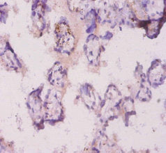 Angpt2 Polyclonal Antibody - image 4