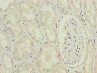 Immunohistochemistry of paraffin-embedded human colon tissue using CAC14164 at dilution of 1:100