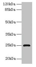RAB32 Polyclonal Antibody - image 2