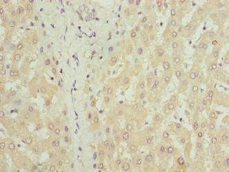 Immunohistochemistry of paraffin-embedded human brain tissue using CAC14182 at dilution of 1:100