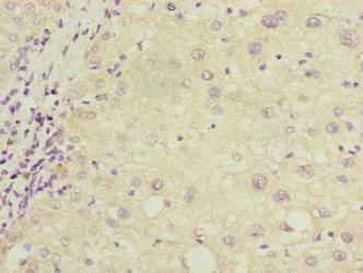 COX17 Polyclonal Antibody - image 5