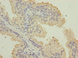 KRT33B Polyclonal Antibody - image 4