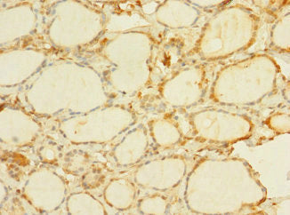 Immunohistochemistry of paraffin-embedded human skin tissue using CAC14198 at dilution of 1:100