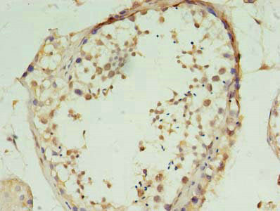Immunohistochemistry of paraffin-embedded human small intestine tissue using CAC14206 at dilution of 1:100