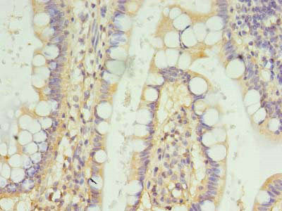FSCB Polyclonal Antibody - image 4
