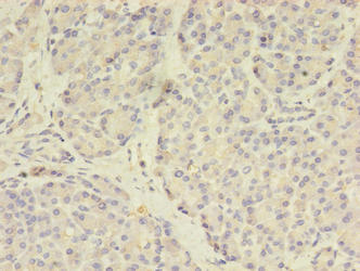 Immunofluorescent analysis of Hela cells using CAC14214 at dilution of 1:100 and Alexa Fluor 488-congugated AffiniPure Goat Anti-Rabbit IgG(H+L)