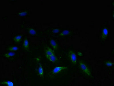 STEAP3 Polyclonal Antibody - image 4