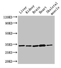 Immunohistochemistry of paraffin-embedded human gastric cancer using CAC14231 at dilution of 1:100
