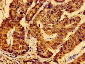 AHSA2P Polyclonal Antibody - image 3