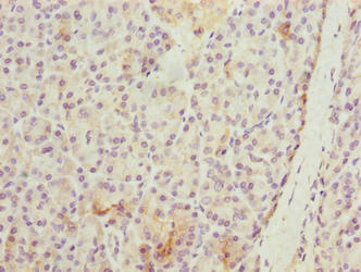 Immunohistochemistry of paraffin-embedded human liver tissue using CAC14237 at dilution of 1:100
