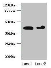ASPHD2 Polyclonal Antibody - image 2