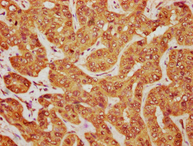 IHC image of CAC14247 diluted at 1:1200 and staining in paraffin-embedded human appendix tissue performed on a Leica BondTM system. After dewaxing and hydration, antigen retrieval was mediated by high pressure in a citrate buffer (pH 6.0). Section was blocked with 10% normal goat serum 30min at RT. Then primary antibody (1% BSA) was incubated at 4°C overnight. The primary is detected by a biotinylated secondary antibody and visualized using an HRP conjugated SP system.