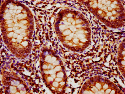 Immunofluorescence staining of NIH/3T3 cells with CAC14247 at 1:400, counter-stained with DAPI. The cells were fixed in 4% formaldehyde, permeabilized using 0.2% Triton X-100 and blocked in 10% normal Goat Serum. The cells were then incubated with the antibody overnight at 4°C. The secondary antibody was Alexa Fluor 488-congugated AffiniPure Goat Anti-Rabbit IgG(H+L).