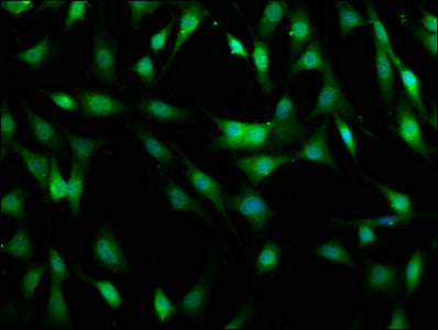 Immunofluorescence staining of Hela cells with CAC14247 at 1:400, counter-stained with DAPI. The cells were fixed in 4% formaldehyde, permeabilized using 0.2% Triton X-100 and blocked in 10% normal Goat Serum. The cells were then incubated with the antibody overnight at 4°C. The secondary antibody was Alexa Fluor 488-congugated AffiniPure Goat Anti-Rabbit IgG(H+L).