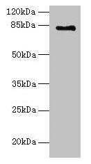 LCA5 Polyclonal Antibody - image 2