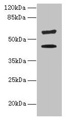 KRT73 Polyclonal Antibody - image 2