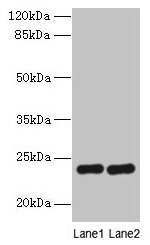 Immunohistochemistry of paraffin-embedded human colon cancer using CAC14262 at dilution of 1:100