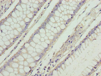 RD3 Polyclonal Antibody - image 3