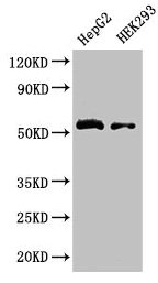 Immunohistochemistry of paraffin-embedded human heart tissue using CAC14263 at dilution of 1:100