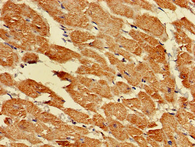 Immunohistochemistry of paraffin-embedded human liver cancer using CAC14263 at dilution of 1:100