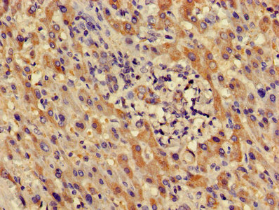 Immunofluorescent analysis of MCF-7 cells using CAC14263 at dilution of 1:100 and Cy3-congugated Goat Anti-Rabbit IgG