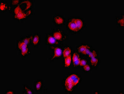 LDHD Polyclonal Antibody - image 5