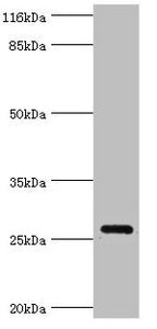 OFCC1 Polyclonal Antibody - image 2