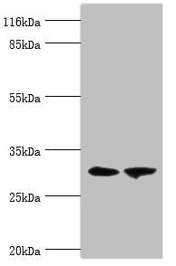 Immunohistochemistry of paraffin-embedded human kidney tissue using CAC14282 at dilution of 1:100